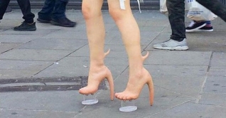 নারীর পায়ে গজিয়েছে ‘শিং’!