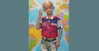 প্রোজেরিয়া আক্রান্ত শিশুদের সনাক্তে পিআরএফের ক্যাম্পেইন