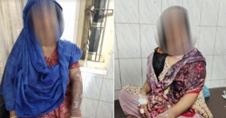 ভোলায় বখাটের আগুনে ঝলসে গেলেন মা-মেয়ে