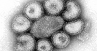 রাশিয়ায় নতুন ধরনের ভাইরাসের সংক্রমণ