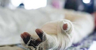 পরীক্ষা কেন্দ্রে মাদ্রাসা ছাত্রীর গায়ে পেট্রল ঢেলে আগুন