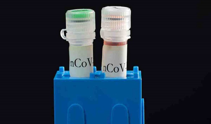 বাংলাদেশকে টেস্ট কিট ও চিকিৎসা সরঞ্জাম দেবে চীন