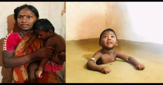 টাকা নেই, আড়াই ফুট গর্তেই চলছে গোপালের চিকিৎসা