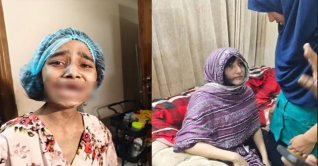 নির্মম নির্যাতনে গৃহকর্মী কল্পনা যেন জীবন্ত লাশ নির্মম নির্যাতনে গৃহকর্মী কল্পনা যেন জীবন্ত লাশ