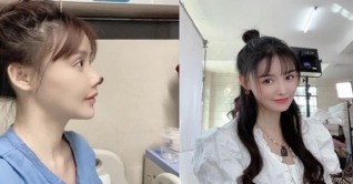 সুন্দরী হওয়ার লোভে নাক কাটতে হলো তারকাকে! সুন্দরী হওয়ার লোভে নাক কাটতে হলো তারকাকে!