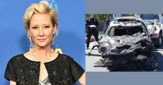 গাড়ি দুর্ঘটনায় অগ্নিদগ্ধ হয়ে হাসপাতালে অভিনেত্রী গাড়ি দুর্ঘটনায় অগ্নিদগ্ধ হয়ে হাসপাতালে অভিনেত্রী