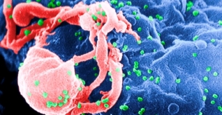 বিশেষ কোনো ওষুধ ছাড়াই এইডস থেকে মুক্তি কানাডীয় নারীর