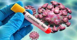 ২৪ ঘণ্টায় ৭ জনের করোনা শনাক্ত ২৪ ঘণ্টায় ৭ জনের করোনা শনাক্ত