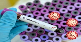 করোনায় দেশে নতুন করে ৯ জনের মৃত্যু, আক্রান্ত ৪৩৪ করোনায় দেশে নতুন করে ৯ জনের মৃত্যু, আক্রান্ত ৪৩৪