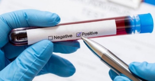 একদিনে করোনায় শনাক্ত ১৫ রোগী একদিনে করোনায় শনাক্ত ১৫ রোগী