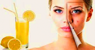 যেসব খাবার ব্রণ থেকে দূরে রাখবে যেসব খাবার ব্রণ থেকে দূরে রাখবে