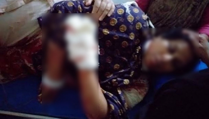 সৈয়দপুর পৌরসভার সাবেক প্যানেল মেয়রের আহত স্ত্রী সুরভী ইসলাম পপি। ছবি : সংগৃহীত