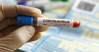 দেশে গত ২৪ ঘণ্টায় ৪ জনের মৃত্যু, শনাক্ত ১২২