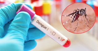 সরকারি হাসপাতালে ৫০ টাকায় হবে ডেঙ্গু পরীক্ষা সরকারি হাসপাতালে ৫০ টাকায় হবে ডেঙ্গু পরীক্ষা