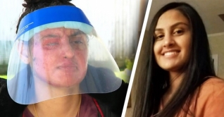 যুক্তরাষ্ট্রে মুসলিম তরুণীর ওপর এসিড হামলা