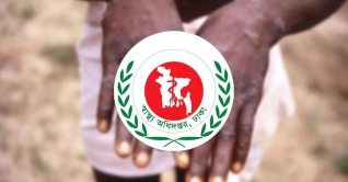 সন্দেহজনক মাঙ্কিপক্স রোগীদের আইসোলেশনের নির্দেশ সন্দেহজনক মাঙ্কিপক্স রোগীদের আইসোলেশনের নির্দেশ