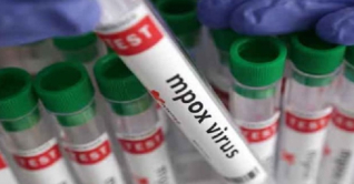 ১৬ দেশে ছড়িয়েছে এমপক্স