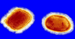 ৩০ দেশে মাঙ্কিপক্স, শনাক্ত ৫৫০ জন