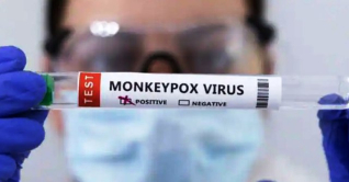 ভারতে বেড়েই চলেছে মাঙ্কিপক্স সংক্রমণ, শনাক্ত বেড়ে ৯