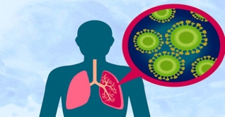 বিশ্ব নিউমোনিয়া দিবস আজ বিশ্ব নিউমোনিয়া দিবস আজ