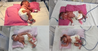 মাইজদীতে একসঙ্গে ৪ সন্তান প্রসব