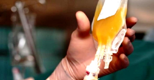 ডেঙ্গু রোগীর কখন প্লাটিলেট নিতে হয়? ডেঙ্গু রোগীর কখন প্লাটিলেট নিতে হয়?