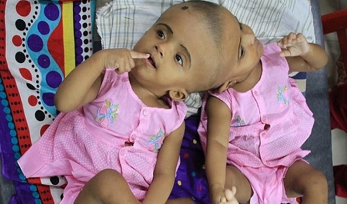 ছবি : সংগ্রহ করা