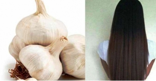 জেনে নিন খুশকি থেকে মুক্তি পেতে রসুনের ব্যবহার জেনে নিন খুশকি থেকে মুক্তি পেতে রসুনের ব্যবহার