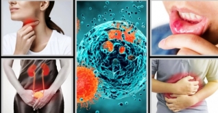 কোন ক্যানসারের আগাম লক্ষণ কোনটি জেনে রাখুন কোন ক্যানসারের আগাম লক্ষণ কোনটি জেনে রাখুন