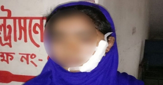 ‘বিয়ের প্রস্তাবে’ রাজি না হওয়ায় কলেজছাত্রীর গালে ক্ষুরাঘাত