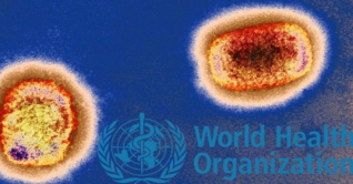 মাঙ্কিপক্স ছড়াল ১৫ দেশে, সতর্ক করলো বিশ্ব স্বাস্থ্য সংস্থা মাঙ্কিপক্স ছড়াল ১৫ দেশে, সতর্ক করলো বিশ্ব স্বাস্থ্য সংস্থা