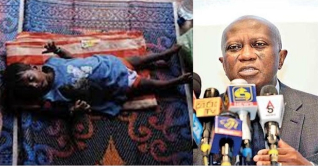 শ্রীলঙ্কায় শিশুরা না খেয়ে ঘুমাতে যায়: জাতিসংঘ 