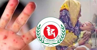 হামের উপসর্গ নিয়ে আরও ৫ শিশুর প্রাণহানি
